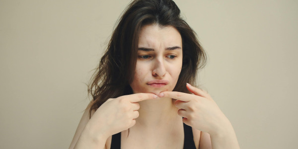 Čo pomáha na akné, ekzém či psoriázu?